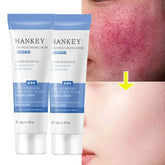 Crème réparatrice pour les rougeurs du visage, améliore la sécheresse de la peau sensible, hydratante, Lotion apaisante, élimination de la Rosacea, cosmétiques coréens