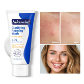 Lavage moussant contre l'acné, nettoyage en profondeur, débouche les Pores, prévient les défauts pour les hydratants du visage et du corps, réduit les rougeurs, soins pour la peau