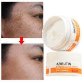 Revitalize your skin with fruit acid peeling gel, exfoliating facial cleanser, deep cleansing scrub, acne and blackhead removal, facial cleanser