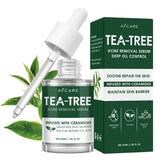 Sérum d'arbre à thé pour l'acné, soulagement végétalien, Non collant, peau claire et équilibrée pour apaiser, apaisant, irrité, hydratant, produit de soins pour la peau