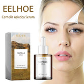 Centella Asiatica sérum 30ml soin de la peau coréen pour le visage hydratant apaisant soulagement des rougeurs Essence visage sensible végétalien soin de la peau