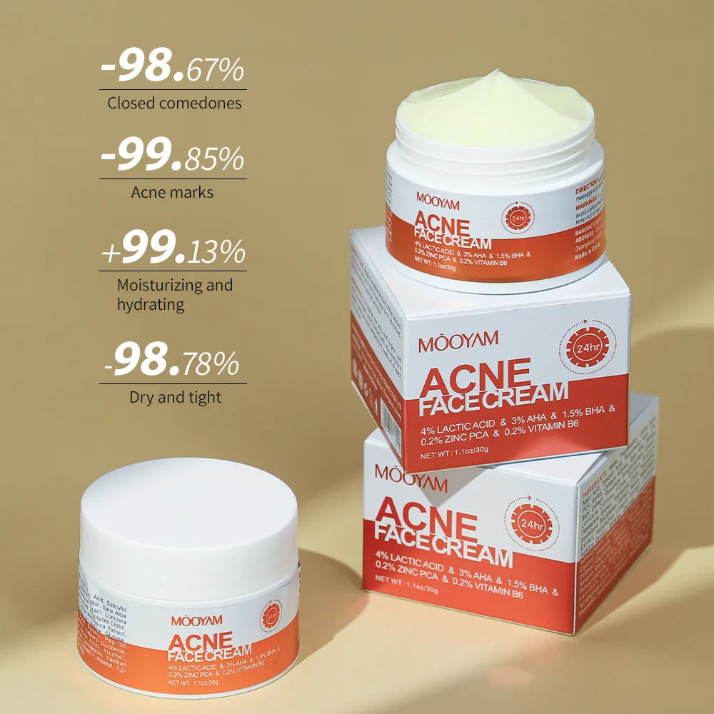 Crème de traitement anti-acné pour le visage, élimine les boutons, les taches, contrôle du sébum, resserre les pores, hydratante, soin de la peau
