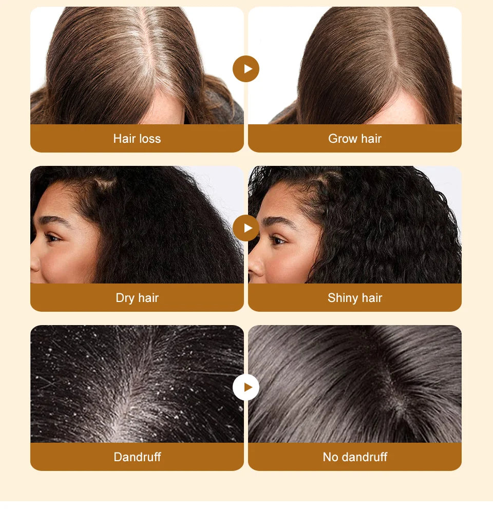 Sérum d'huile de Batana pour la croissance des cheveux, huile essentielle pour cheveux à croissance rapide, soins capillaires de beauté, Essence Anti-perte de cheveux, réparation naturelle des cheveux endommagés
