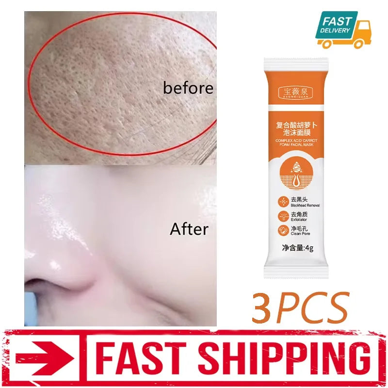 Sérum pour le visage anti-acidité, rétrécissement des pores, élimination des points noirs, contrôle de l'acné, réparation de l'huile, essence hydratante, nourrit les pores, raffermissant, soin du visage