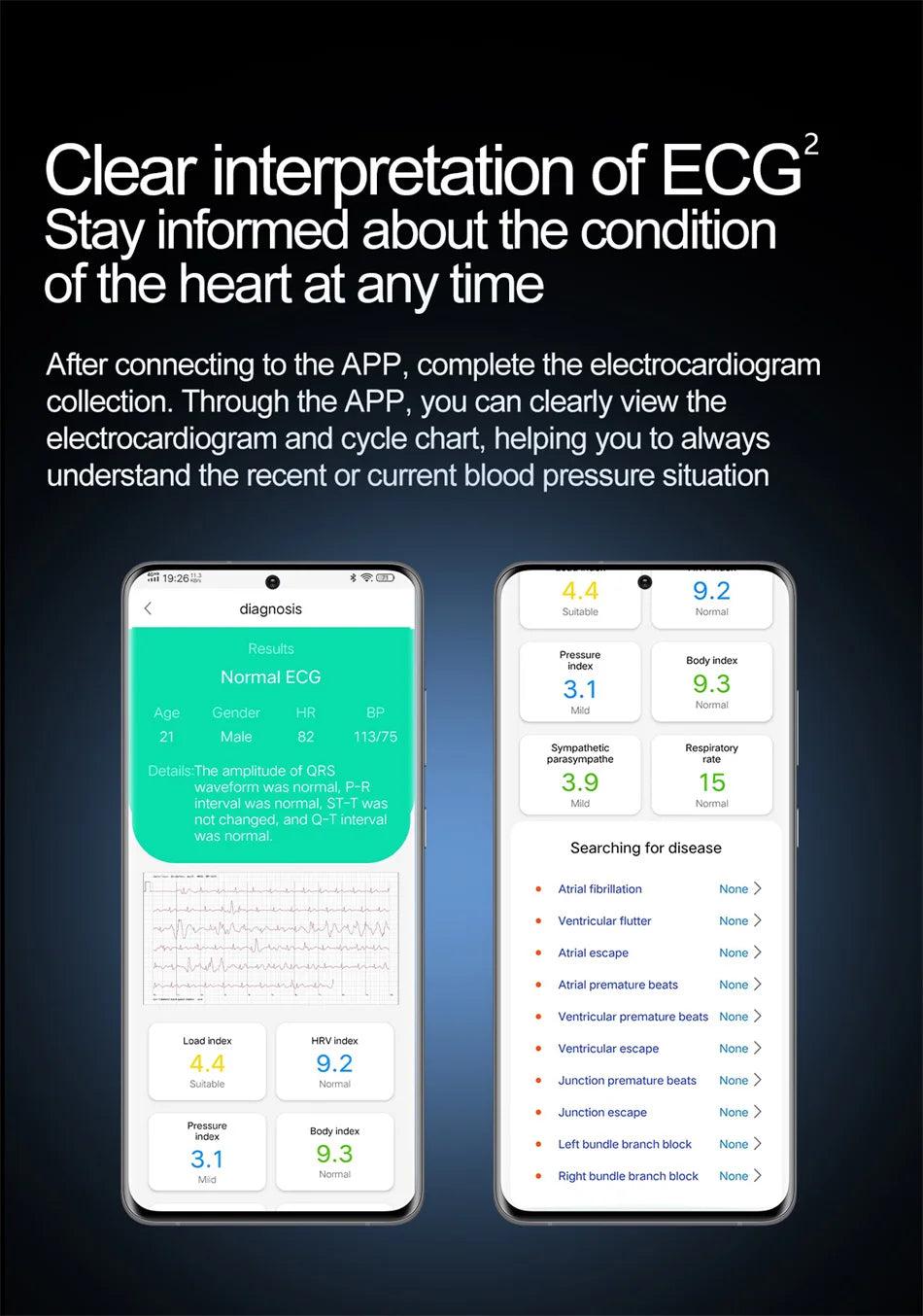 2025 santé montre intelligente NFC ECG pompe à Air pression artérielle oxygène sanguin ECG + PPG Bluetooth appel NFC montre intelligente pour hommes femmes Airbag