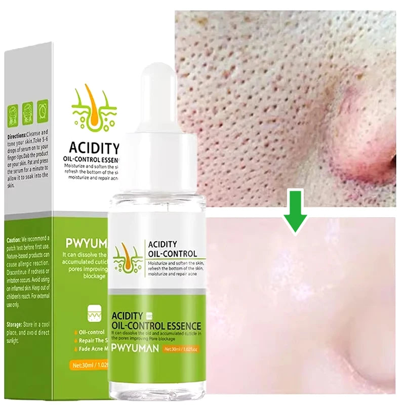 Crème rétrécissante pour les pores à l'acide salicylique, élimine les grands Pores, sérum, élimine les points noirs, répare l'acné, raffermissement, soins pour la peau, cosmétiques