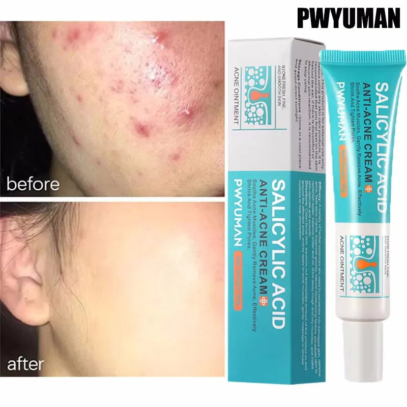 Sérum rétrécissement des pores à l'acide salicylique, élimination rapide des grands Pores, élimine les points noirs, l'acné, resserre la peau lisse, produit de soins coréen