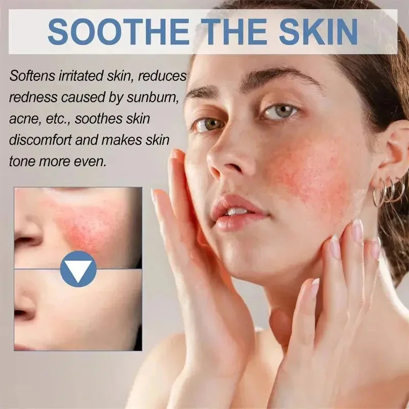 Crème réparatrice pour les rougeurs du visage, améliore la sécheresse de la peau sensible, hydratante, Lotion apaisante, élimination de la Rosacea, cosmétiques coréens