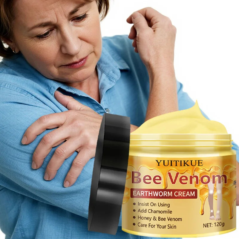 YUITIKUE Crème pour varices 120g - Formule de venin d'abeille et de vers de terre, hydratant et massage en profondeur, traitement de soins de la peau