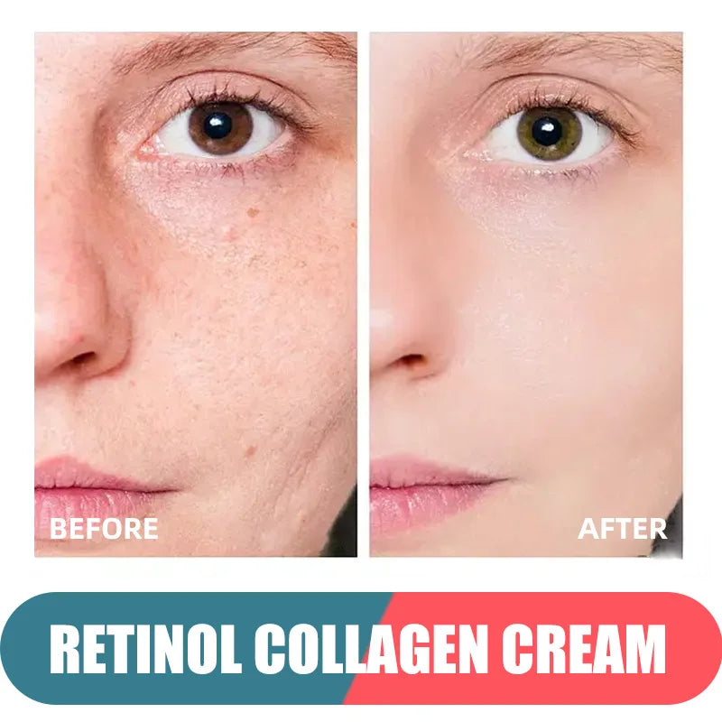 Crème pour le visage au rétinol, hydratante, raffermissante, éclaircissante, au collagène, à l'acide hyaluronique, produits de soins pour la peau, 50ml