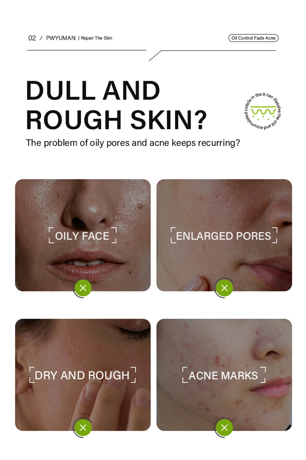 Sérum rétrécissement des pores à l'acide salicylique, élimination rapide des grands Pores, élimine les points noirs, l'acné, resserre la peau lisse, produit de soins coréen