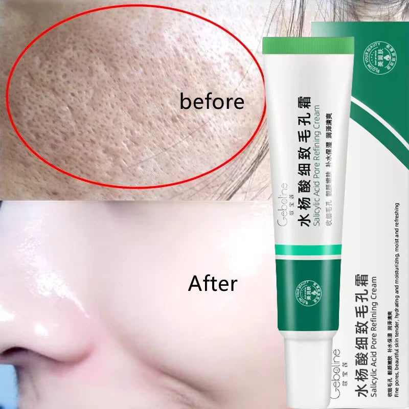 Crème rétrécissante pour les pores à l'acide salicylique, élimine les grands Pores, sérum, élimine les points noirs, répare l'acné, raffermissement, soins pour la peau, cosmétiques
