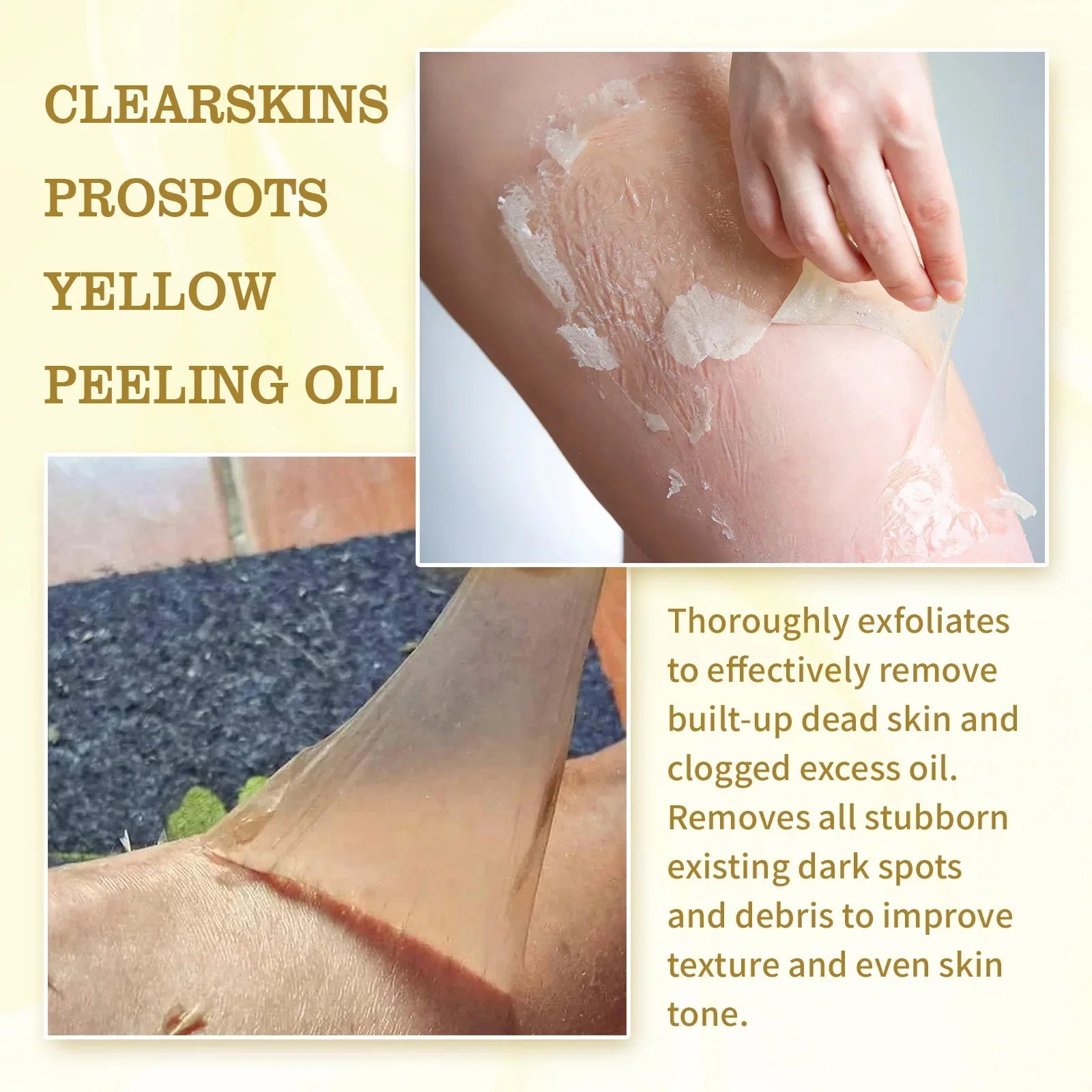 Huile de Peeling Jaune pour le Bain, Accessoire pour Blanchir la Peau Foncée, Éclaircir le Corps, les Coudes, les Genoux, la Main, Fréquence Exexponsive, Nourrir la Peau