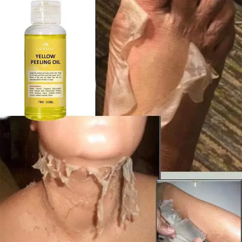 Huile de Peeling Jaune pour le Bain, Accessoire pour Blanchir la Peau Foncée, Éclaircir le Corps, les Coudes, les Genoux, la Main, Fréquence Exexponsive, Nourrir la Peau