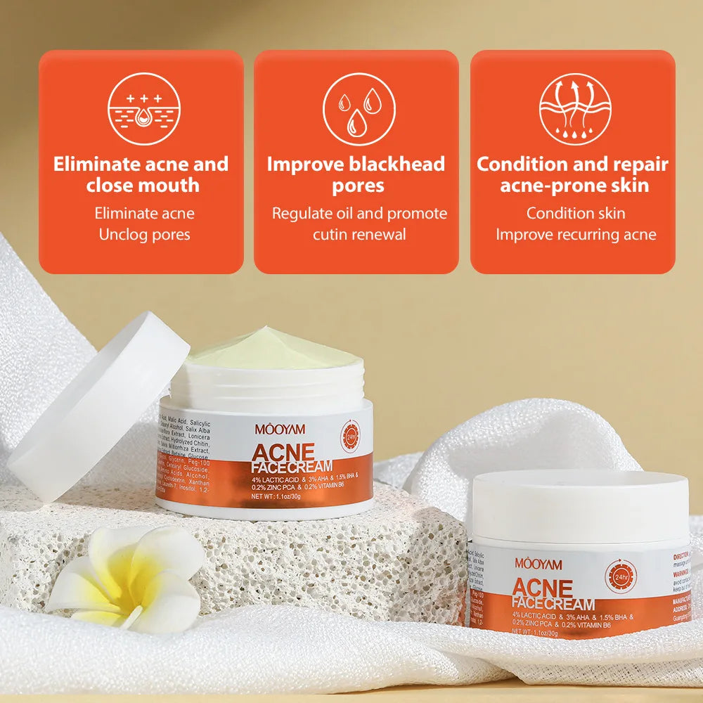 Crème pour le visage à base de plantes pour l'élimination de l'acné, Gel Anti-acné, traitement des cicatrices d'acné, rétrécissement des pores, élimine les grands Pores, les boutons, blanchiment du visage, voiture