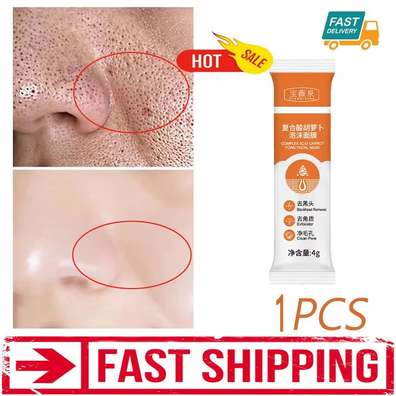 Sérum pour le visage anti-acidité, rétrécissement des pores, élimination des points noirs, contrôle de l'acné, réparation de l'huile, essence hydratante, nourrit les pores, raffermissant, soin du visage