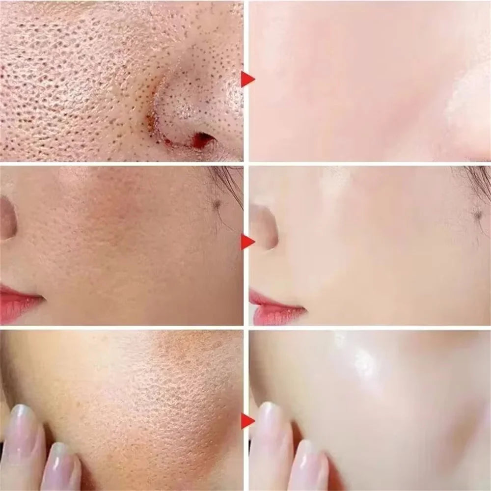 Sérum rétrécissement des pores à l'acide salicylique, élimination rapide des grands Pores, élimine les points noirs, l'acné, resserre la peau lisse, produit de soins coréen