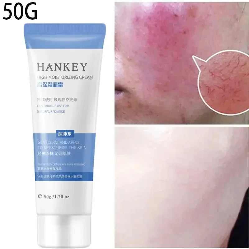 Crème réparatrice pour les rougeurs du visage, améliore la sécheresse de la peau sensible, hydratante, Lotion apaisante, élimination de la Rosacea, cosmétiques coréens