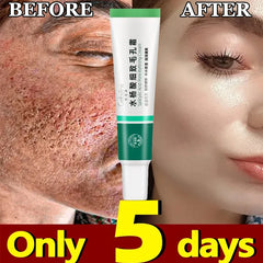 Crème rétrécissante pour les pores à l'acide salicylique, élimine les grands Pores, sérum, élimine les points noirs, répare l'acné, raffermissement, soins pour la peau, cosmétiques