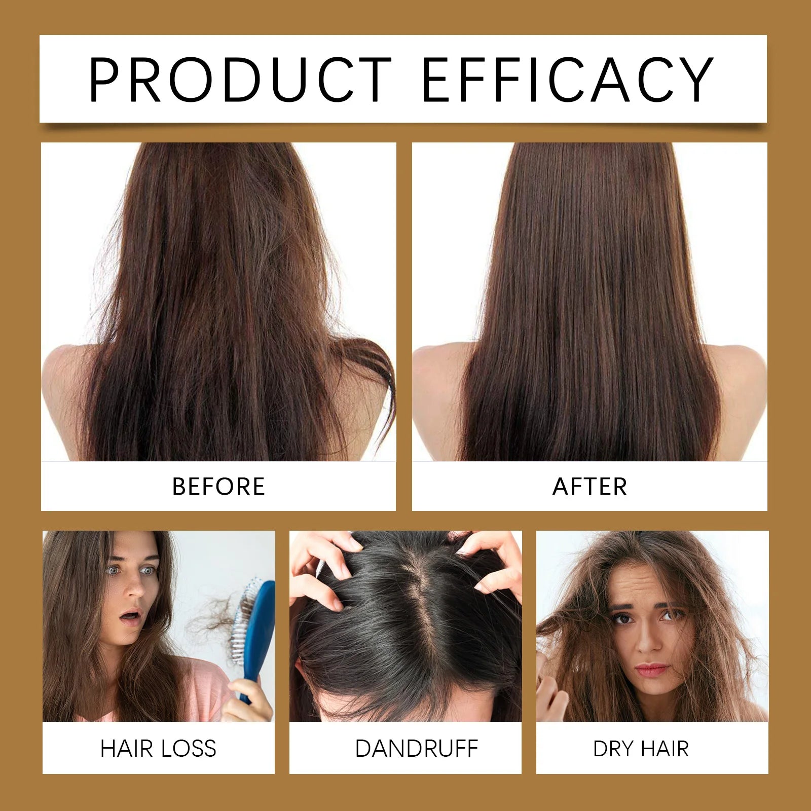 Shampoing Anti-perte de cheveux pour la croissance des cheveux, follicules nourrissantes, soulagement des démangeaisons du cuir chevelu, frisottis secs, pointes fourchues, réparation des cheveux endommagés