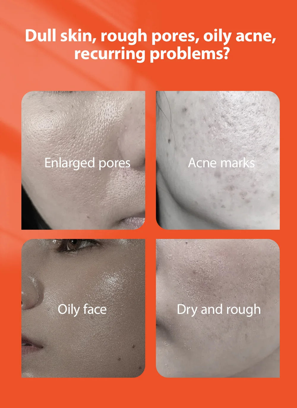 Crème pour le visage à base de plantes pour l'élimination de l'acné, Gel Anti-acné, traitement des cicatrices d'acné, rétrécissement des pores, élimine les grands Pores, les boutons, blanchiment du visage, voiture