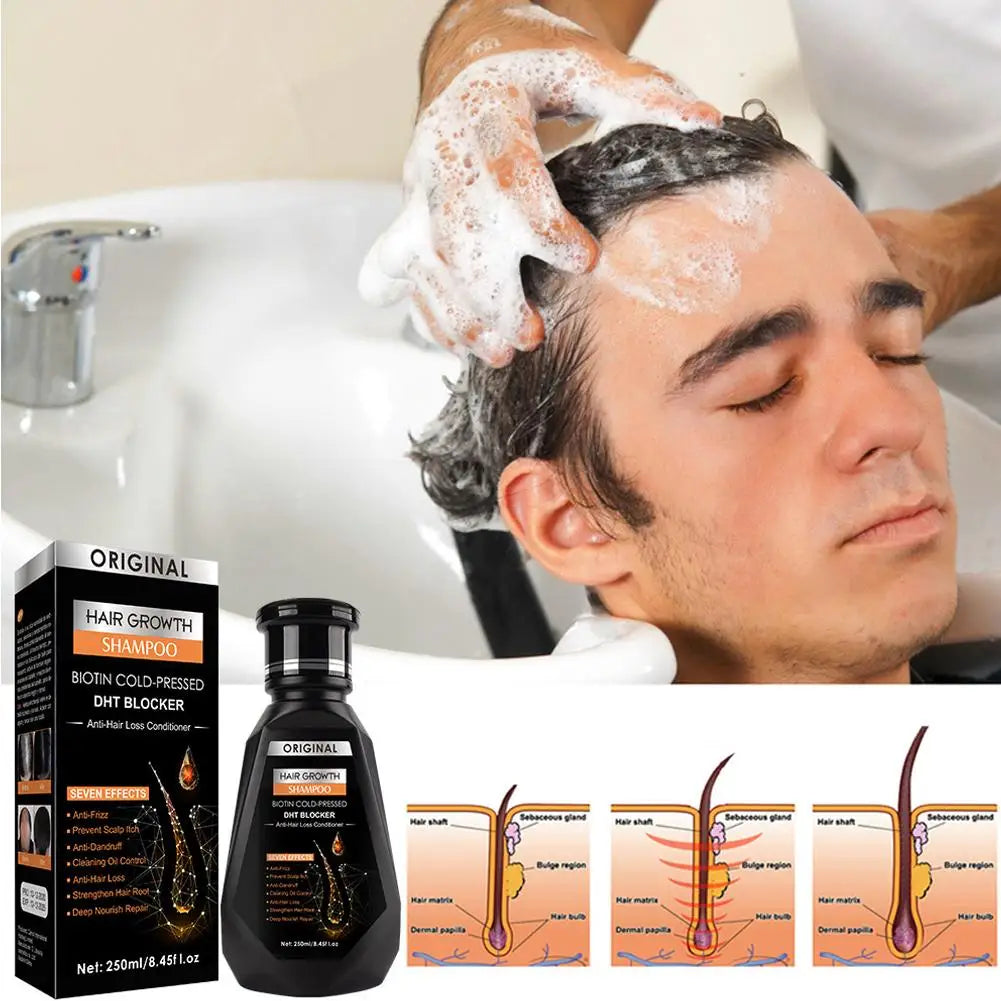 Shampoing à la biotine de 250 ml pour la croissance des cheveux et les cheveux amincissants – Shampooing au gingembre, formule épaississante pour le traitement de la perte de cheveux pour femmes et hommes