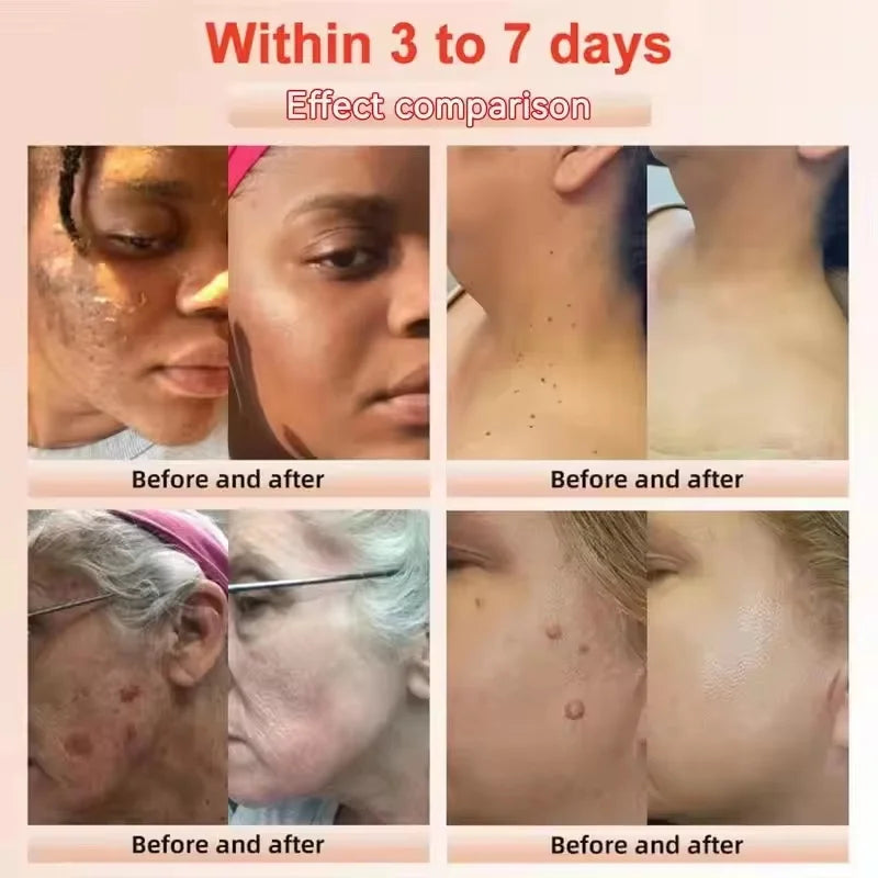 Revitalisez la peau acide de fruits Peeling Gel nettoyage du visage exfoliant Peeling gommage nettoyage en profondeur acné points noirs enlever visage nettoyant