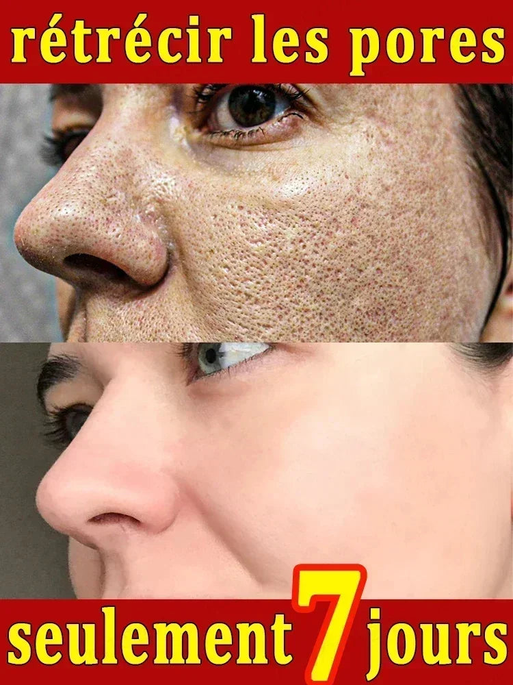Crème rétrécissante pour les pores à l'acide salicylique, élimine les grands Pores, sérum, élimine les points noirs, répare l'acné, raffermissement, soins pour la peau, cosmétiques