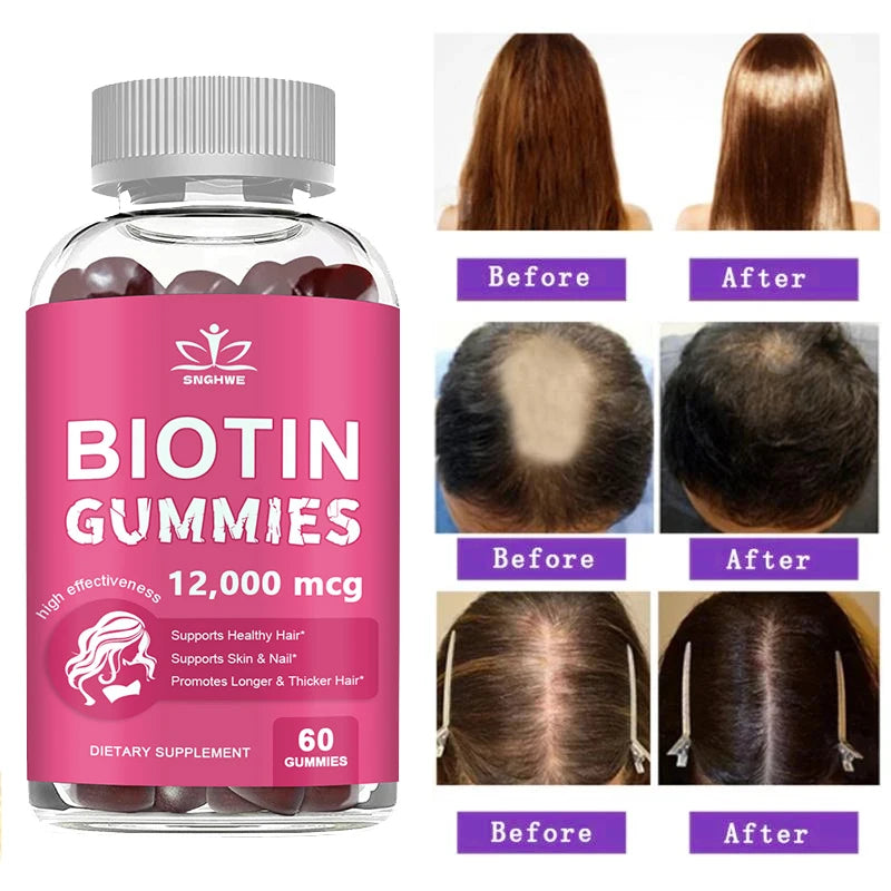 Gommes au collagène, gommes à biotine pour soins de la peau, santé des ongles, croissance des cheveux, vitamines, supplément de protéines au collagène