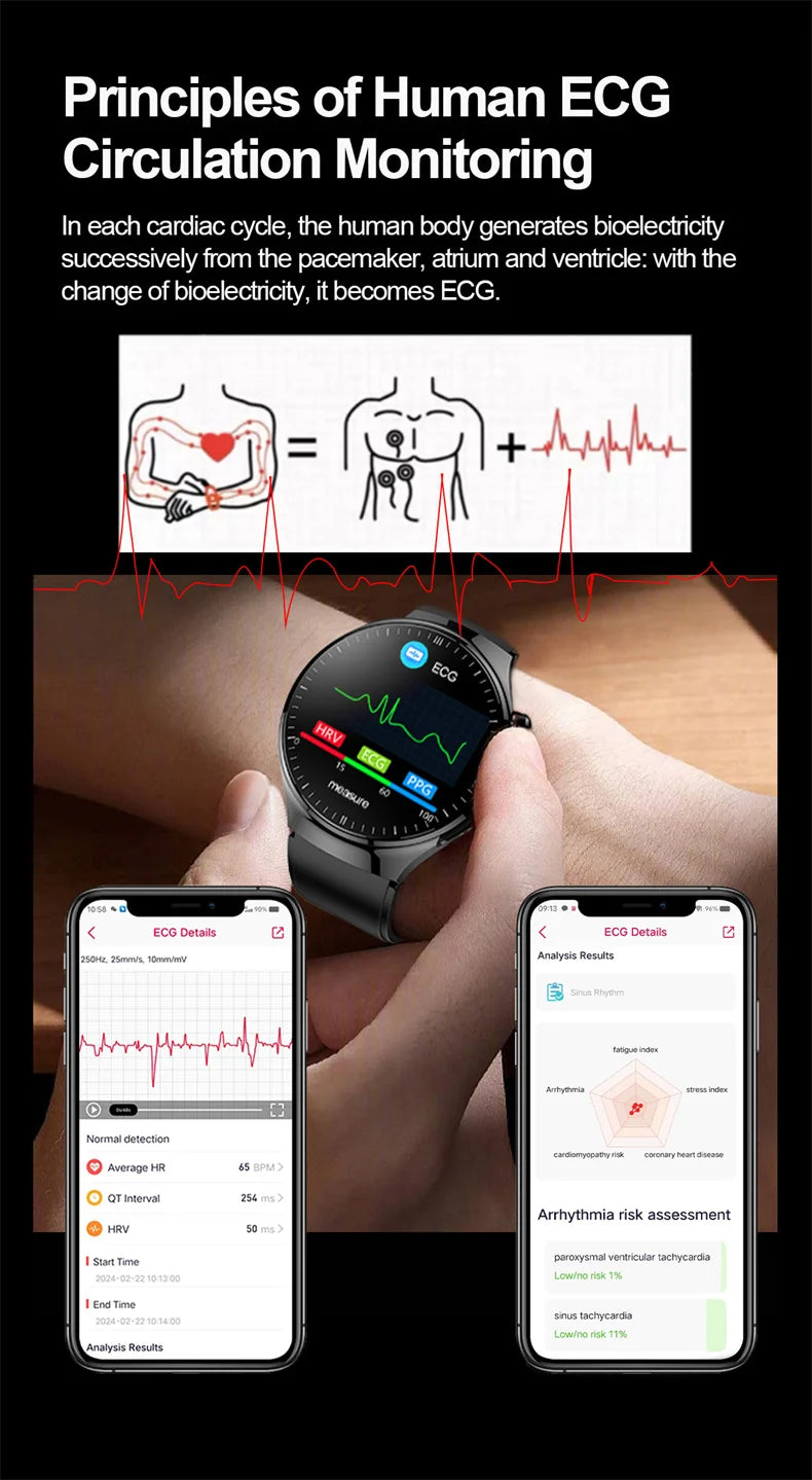 Nouvelle surveillance de la santé montre intelligente examen physique santé Wacth pression artérielle ECG + PPG Sport appel Smartwatch pour Android iOS