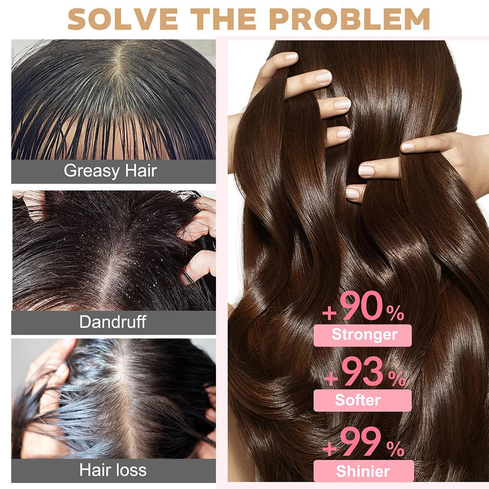 Shampoing à la biotine de 250 ml pour la croissance des cheveux et les cheveux amincissants – Shampooing au gingembre, formule épaississante pour le traitement de la perte de cheveux pour femmes et hommes