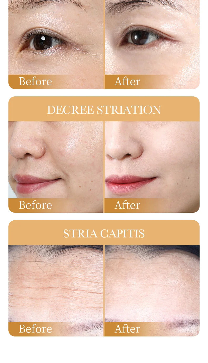 Masque Facial Anti-rides au collagène, 10 pièces, Anti-vieillissement, estompe les ridules, peau ferme, hydratant, éclaircissant, soins de la peau, cosmétiques coréens