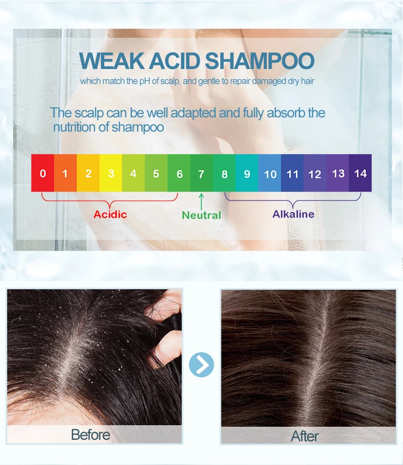 PURC-Shampoing en Polygonum pour Cheveux Gris et Blanc, Barre de Traitement du Cuir oral elu, au Charbon de Bambou de Regina, Solide, 60g