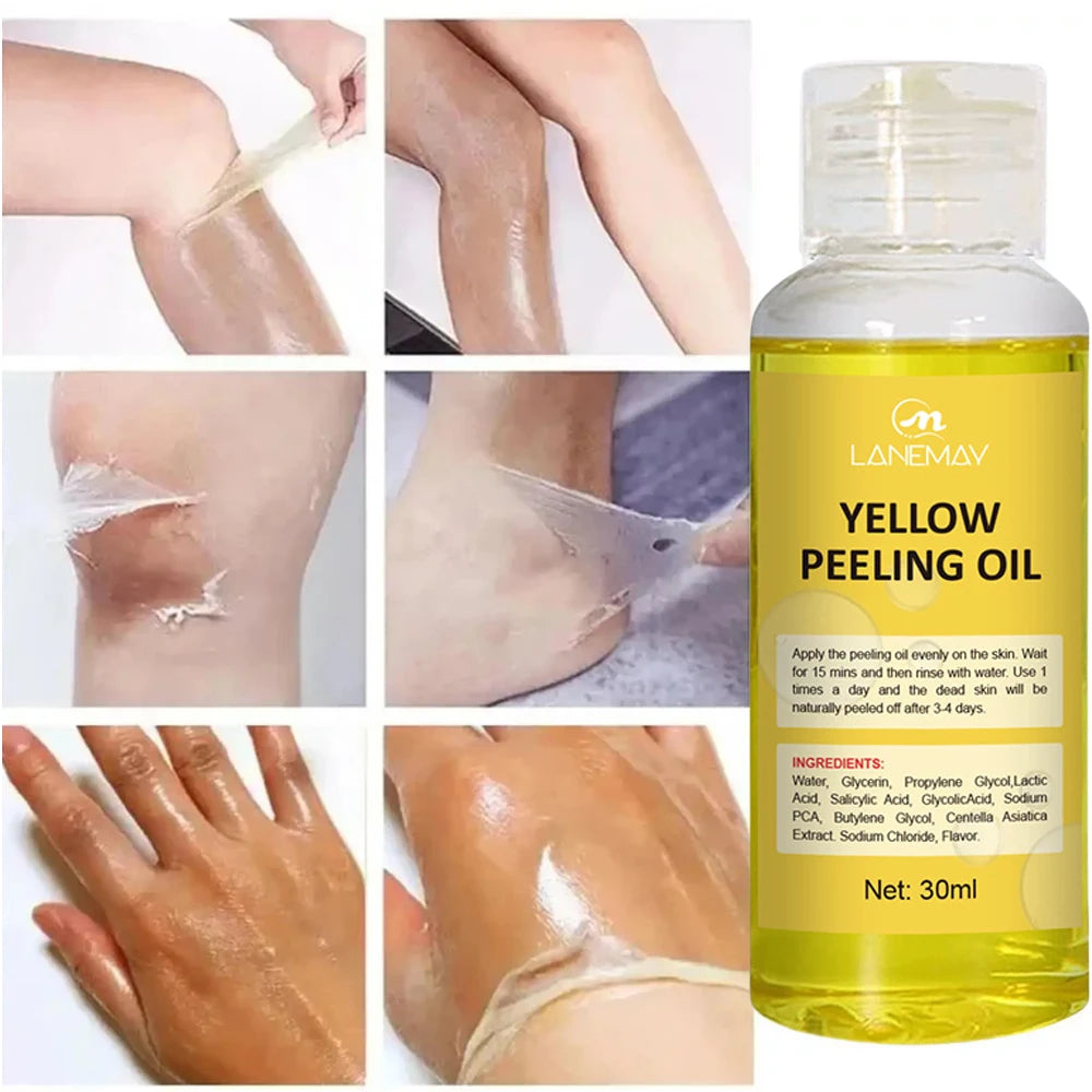 Huile de Peeling Jaune pour le Bain, Accessoire pour Blanchir la Peau Foncée, Éclaircir le Corps, les Coudes, les Genoux, la Main, Fréquence Exexponsive, Nourrir la Peau