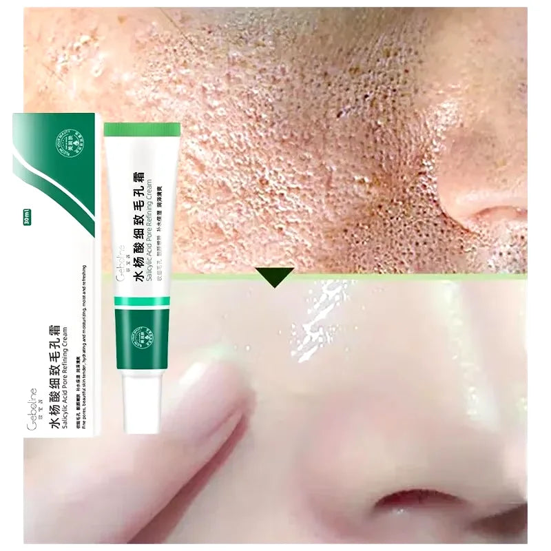 Crème rétrécissante pour les pores à l'acide salicylique, élimine les grands Pores, sérum, élimine les points noirs, répare l'acné, raffermissement, soins pour la peau, cosmétiques
