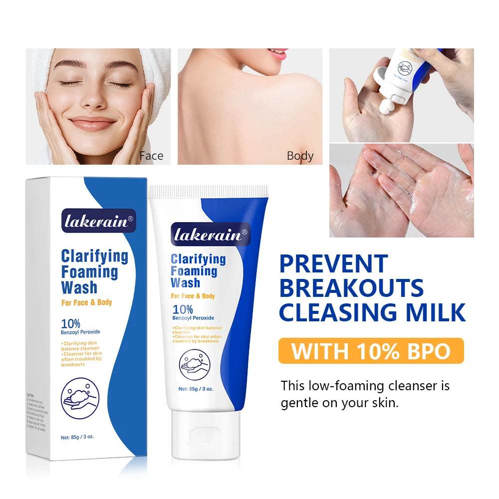 Lavage moussant contre l'acné, peroxyde de benzoyl, 10% Maximum antimicrobie, contrôle de l'huile, réduit les rougeurs, nettoyage en profondeur pour les soins de la peau du visage et du corps