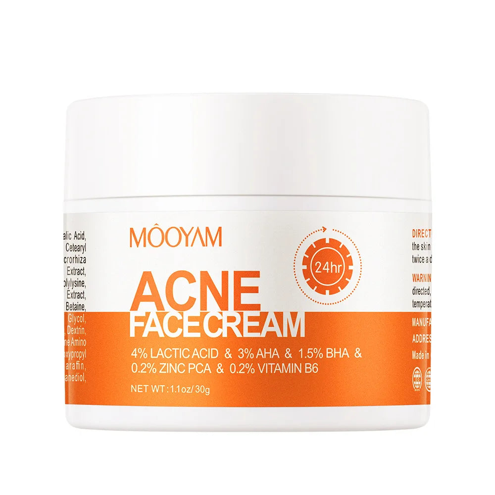 Crème de traitement anti-acné pour le visage, élimine les boutons, les taches, contrôle du sébum, resserre les pores, hydratante, soin de la peau