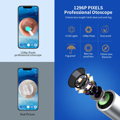 NE3 nettoyeur d'oreilles outil de retrait de cire d'oreille de haute précision avec caméra LED Otoscope sans fil Kit de nettoyage d'oreille intelligent meilleur cadeau