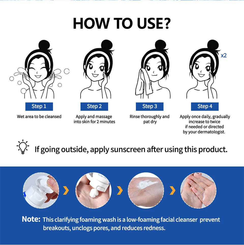 Lavage moussant contre l'acné, nettoyage en profondeur, débouche les Pores, prévient les défauts pour les hydratants du visage et du corps, réduit les rougeurs, soins pour la peau