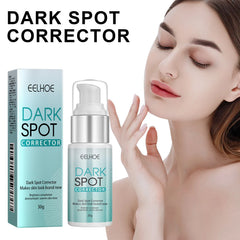 EELHOE – crème anti-taches foncées pour le visage, élimination de la pigmentation, mélasma, élimine l'hydratation en profondeur, éclaircissante pour la peau, crème Anti-taches de rousseur, 30g