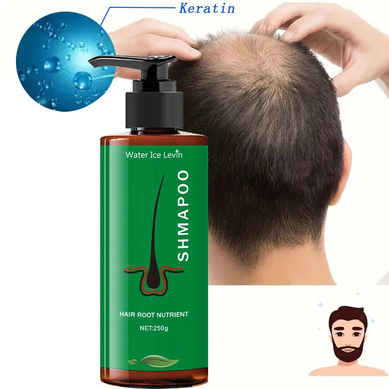 Shampoing nutritionnel racine 250g, adapté aux types de cheveux normaux de formule hydratante, soins capillaires quotidiens, conception de bouteille lisse, ingrédients naturels