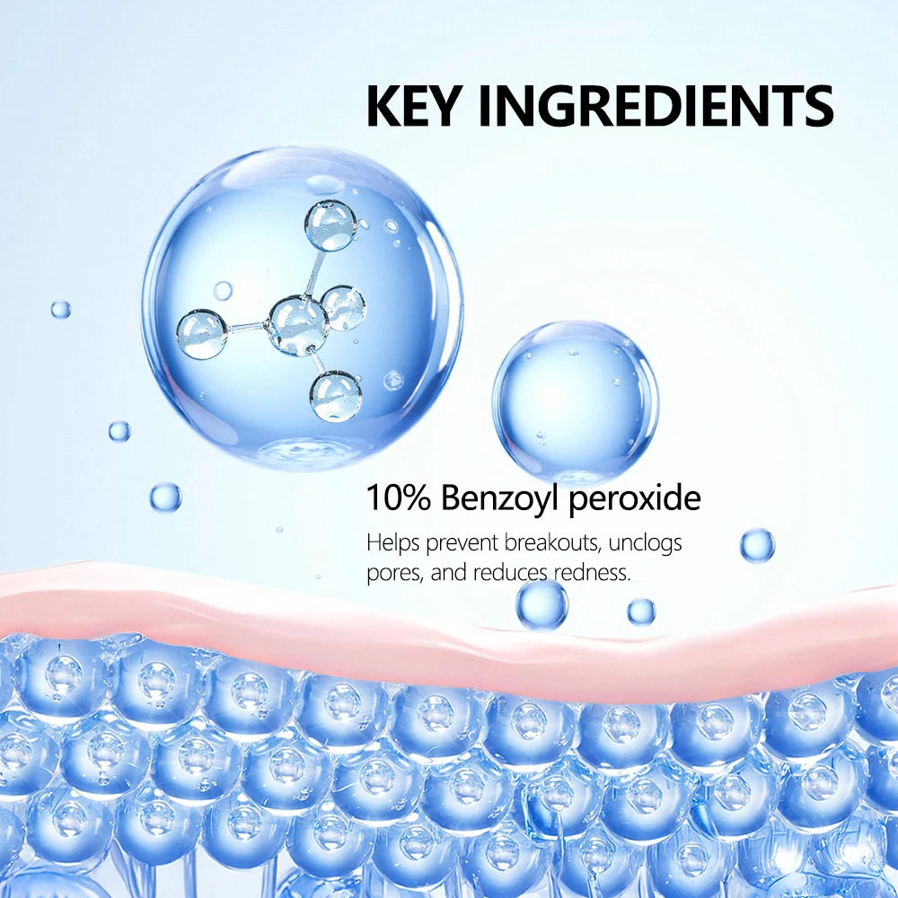 Lavage moussant contre l'acné, peroxyde de benzoyl, 10% Maximum antimicrobie, contrôle de l'huile, réduit les rougeurs, nettoyage en profondeur pour les soins de la peau du visage et du corps