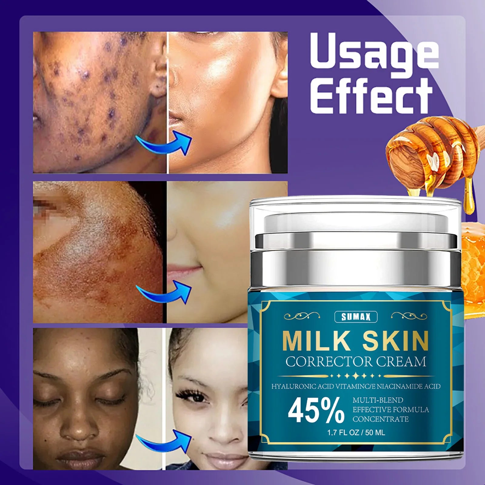 Sumax-Crème pour le visage au collagène de rétinol, soin hydratant à l'acide hyaluronique, raffermissant et éclaircissant à 5%, 50ml
