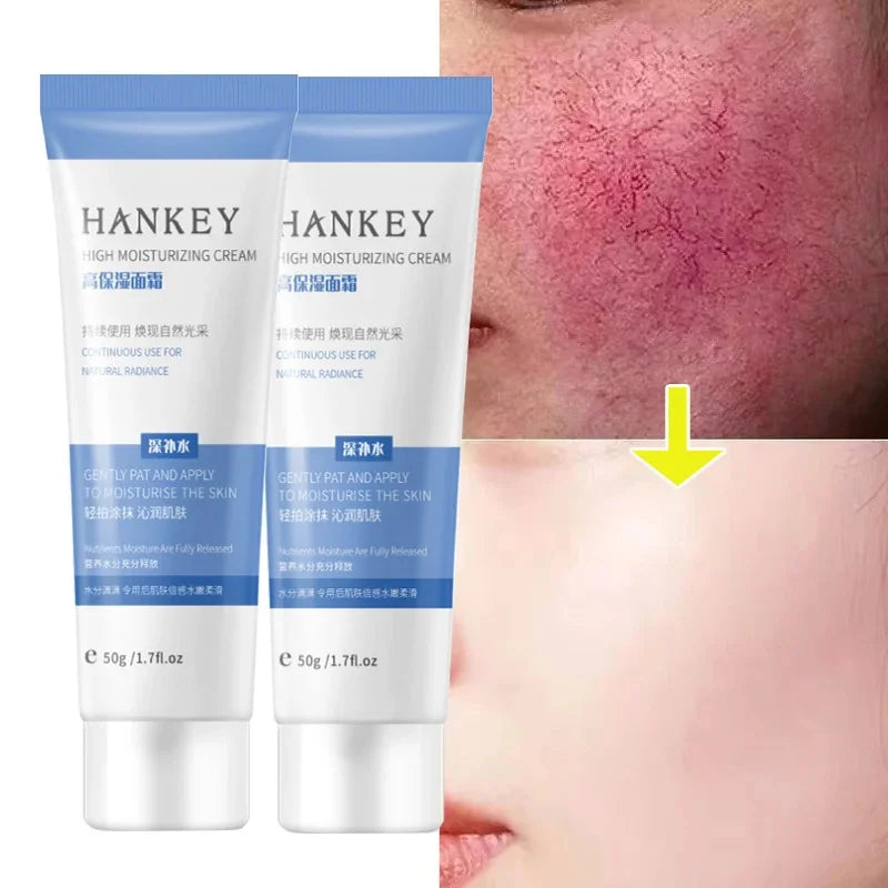 Crème réparatrice pour les rougeurs du visage, améliore la sécheresse de la peau sensible, hydratante, Lotion apaisante, élimination de la Rosacea, cosmétiques coréens