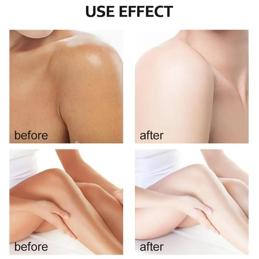 Sérum blanchissant jaune Wiltshire Peeling, huile de soin de la peau à fréquence exponsive, peau foncée, enlever les bras, les genoux, les jambes, mélanine, gIslande éclaircissant pour le corps