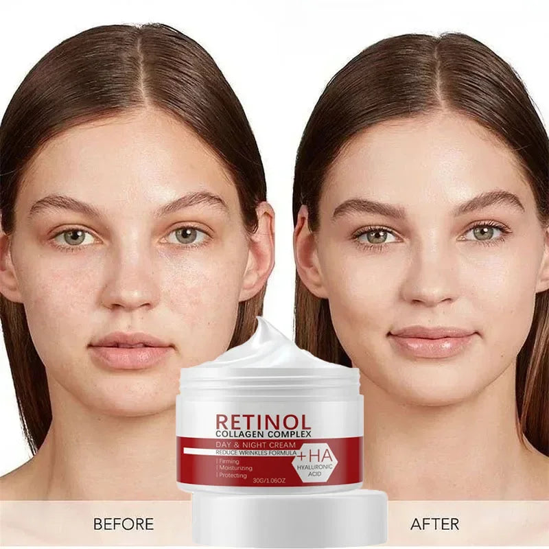 Crème blanchissante pour le visage et le corps, rétinol, collagène, acide hyaluronique 3 en 1, élimine les taches foncées, élimine la mélanine, dissipe l'acné, éclaircit la peau