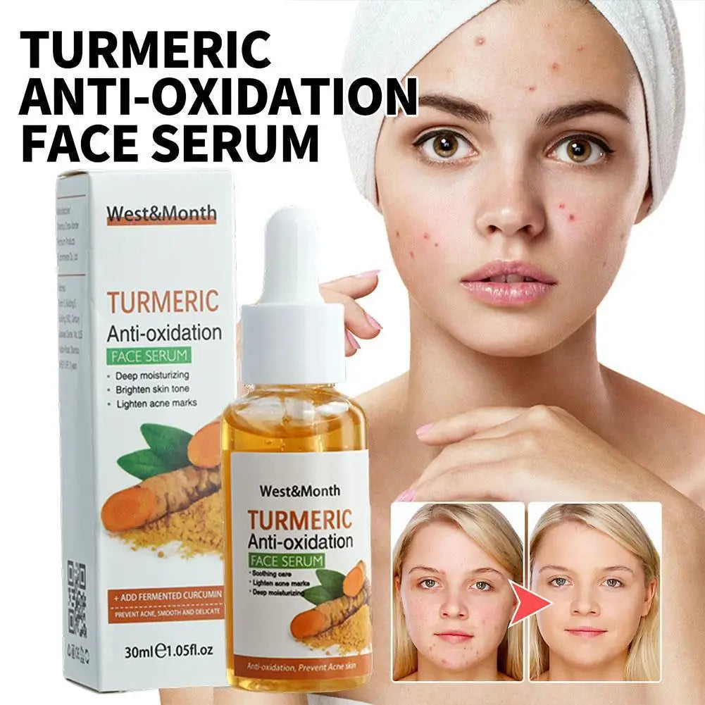 Sérum blanchissant pour le visage au curcuma, anti-d'effets, ration des taches foncées, éclaircissant pour le visage, huile de curcuma Regina