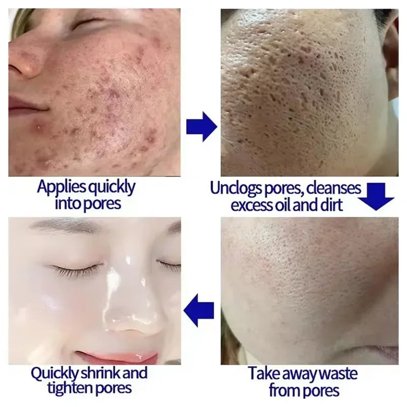 Crème rétrécissante pour les pores à l'acide salicylique, élimine les grands Pores, sérum, élimine les points noirs, répare l'acné, raffermissement, soins pour la peau, cosmétiques
