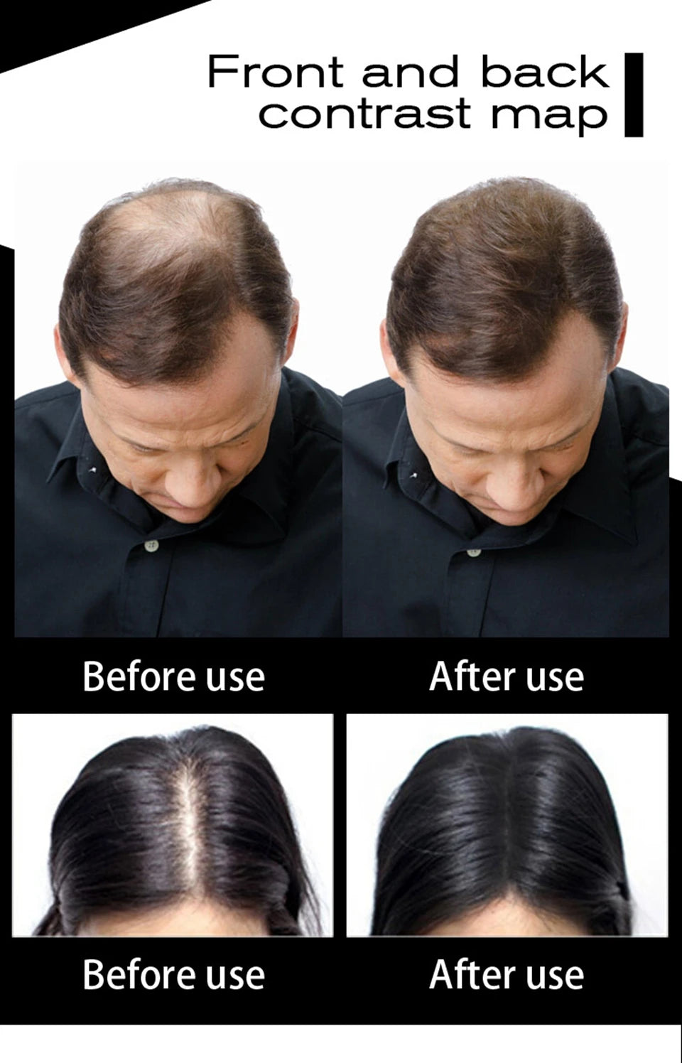 SEVICH fibre de cheveux 100g kératine fibre de cheveux poudre épaississante fibre de renforcement des cheveux Spray poudre de repousse instantanée perte de cheveux dissimuler