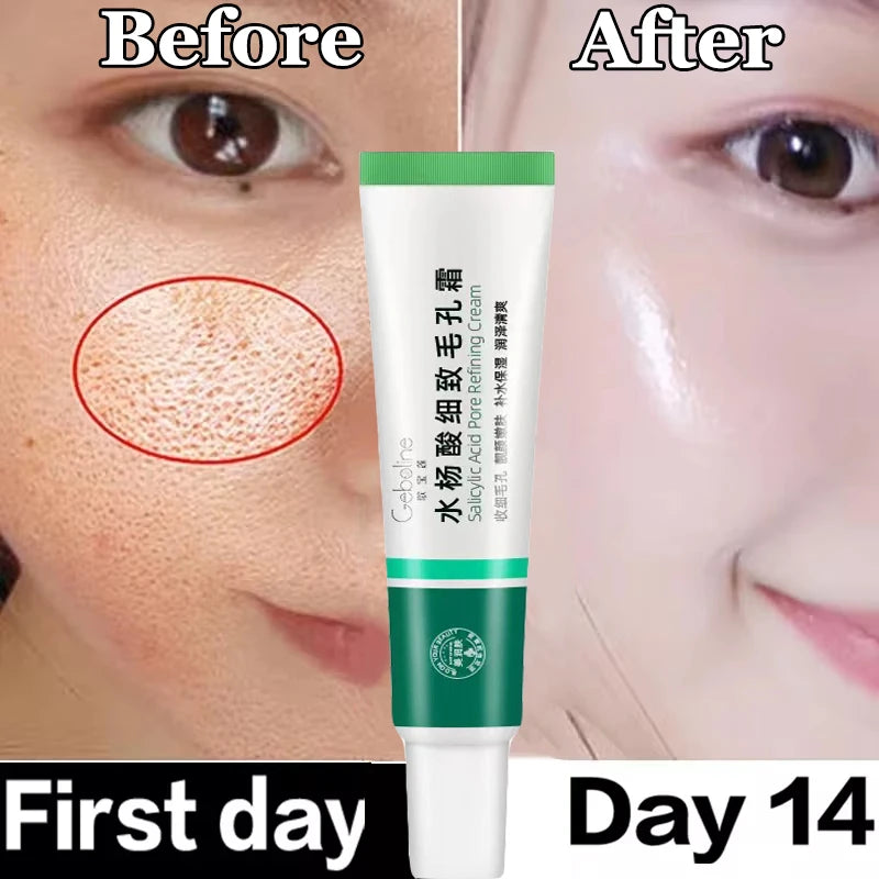 Crème rétrécissante pour les pores à l'acide salicylique, élimine les grands Pores, sérum, élimine les points noirs, répare l'acné, raffermissement, soins pour la peau, cosmétiques